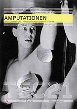 TEC21 2007|35 Amputationen